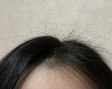 PURC-productos para el crecimiento del cabello para hombres y mujeres, aceite de crecimiento rápido, cuidado para la pérdida del cabello, tratamiento para el cuero cabelludo y el cabello, 30ml