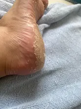 6 uds = 3 pares lavanda/Aloe máscara eliminar la piel muerta pie pelado máscara para las piernas calcetines exfoliantes pedicura Anti grieta de talón