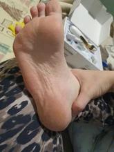 Foot-Care-Tool Skin-Removal Cracked-Heels Electric 5-Rollers with Dead-Dry for Cuticles