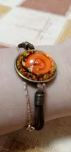 Pulseras de cuero de zorro durmiente, cristal redondo de 20mm, accesorios de mano con patrón bonito, 2020