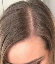 PURC-productos para el crecimiento del cabello para hombres y mujeres, aceite de crecimiento rápido, cuidado para la pérdida del cabello, tratamiento para el cuero cabelludo y el cabello, 30ml