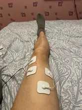 Electrode-Pads Massager-Patch Acupuncture-Physiotherapy-Machine Nerve Tens Muscle-Stimulator