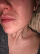 BREYLEE-suero Retinol, esencia para el rostro reafirmante, Lifting, reafirmante, colágeno, elimina las arrugas, alivia las líneas finas, aprieta la piel