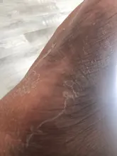 Aloe Vera máscara pelar para las piernas pies máscara exfoliante calcetines exfoliantes pedicura Anti grieta de talón eliminar parche de pie