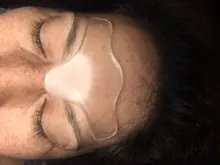 Almohadillas de silicona VIP Link, parches antigripal, pegatina de extracción, cara, cuello, etiqueta adhesiva para ojos, 16 Uds.