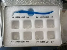 Kit de molde de impresión Dental Posterior, herramientas de llenado de restauración Dental