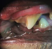 Raspador Dental ultrasónico, eliminador de cálculo Dental, herramientas de escalado Dental, raspador de dientes eléctrico portátil, pantalla inteligente, limpiador de dientes de agua