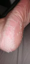 Aloe Vera máscara pelar para las piernas pies máscara exfoliante calcetines exfoliantes pedicura Anti grieta de talón eliminar parche de pie