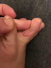 Parches médicos para el cuidado de los pies, almohadillas de eliminación de maíz, espinillas, parches curativos, elimina callosidades, desintoxicación, 30 Uds.