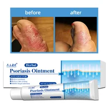 

Against Psoriasis Cream Aloe Vera Antibacterial Gel Anti-itch Relief Eczema Treatment Rash Urticaria Desquamation Body Skin Care