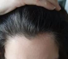 HAIRCUBE-esencia para el crecimiento del cabello para hombres y mujeres, suero para el crecimiento del cabello, Germinal rápido, cuidado del cabello, reparación, líquido antipérdida de cabello más grueso