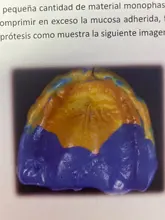 Bandejas de impresión Dental de colores, materiales de plástico, soporte para dientes, 6 uds.