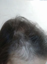 Fibras de reconstrucción del cabello, productos contra la caída del cabello más gruesos de queratina, corrector de relleno, polvos de fibra espesante para el crecimiento del cabello, sevich 25g