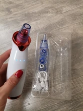 Limpiador eléctrico de acné y puntos negros, herramienta de limpieza al vacío para puntos negros y acné