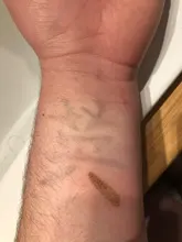 Bolígrafo de Plasma láser peca removedor de LCD topo eliminación mancha removedor de piel verruga etiqueta tatuaje Remaval herramienta de salón de belleza