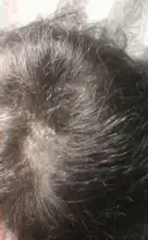 Suero para el crecimiento del cabello de jengibre, tratamiento para la pérdida del cabello con Spray, aceite esencial para el crecimiento del cabello Germinal efectivo en 7 días, cuidado del cabello para hombres y mujeres, 30ml