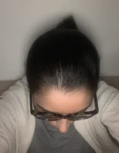 Suero para el crecimiento del cabello de jengibre, tratamiento para la pérdida del cabello con Spray, aceite esencial para el crecimiento del cabello Germinal efectivo en 7 días, cuidado del cabello para hombres y mujeres, 30ml