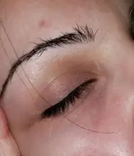 BREYLEE-suero Retinol, esencia para el rostro reafirmante, Lifting, reafirmante, colágeno, elimina las arrugas, alivia las líneas finas, aprieta la piel