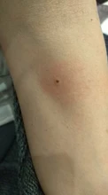 Remove-Pen Skin-Care Tattoo-Removal Beauty-Machine Laser Mole Freckle Dark-Spot Facial