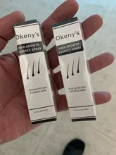 Esencia de crecimiento de cabello de jengibre para hombre y mujer, suero de crecimiento para la pérdida de cabello, Spray para restauración de crecimiento, previene la calvicie, 20ml