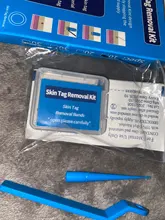 Kit de eliminación de verrugas y microbanda para la piel, eliminador de verrugas con hisopo de limpieza, topos y verrugas para adultos, cuidado facial