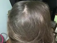 HAIRCUBE-esencia para el crecimiento del cabello, tratamiento para la pérdida del cabello, anticaída, prevención, Alopecia, líquido dañado, reparación del cabello