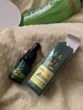 Aceite de esencia de crecimiento de pelo rápido, suero para el crecimiento del cabello de jengibre, tratamiento nutritivo para suavizar la pérdida de cabello, reparación de cabello dañado, 10/30ML, 7 días