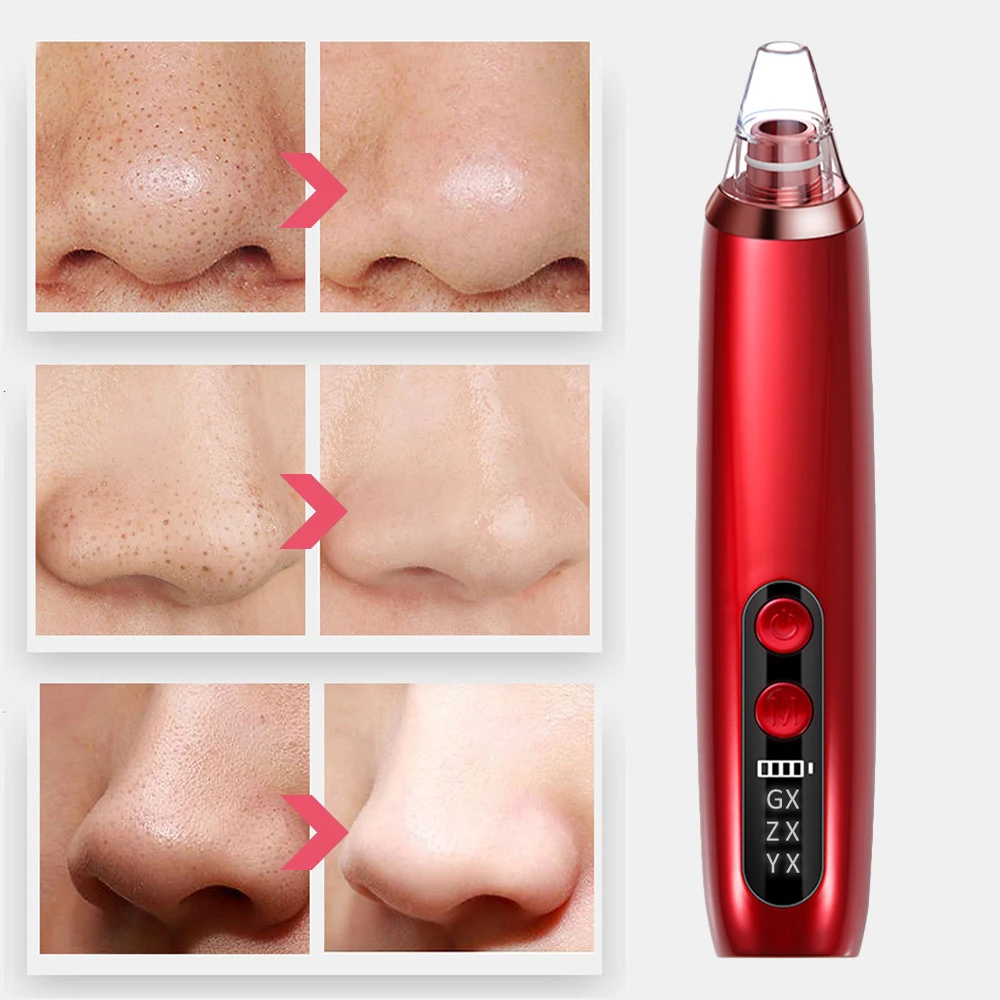 476958_3_bec6a46066c34e63a2bf0fbe2a58635d