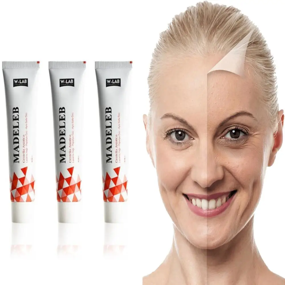 Madeleb Skin Renewal Face Cream Blackhead Remover 1/2/3 Pcs 40 ml Skin Wounds Eczema Acne Problems Cell Regeneration Original