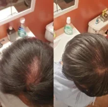 Champú y acondicionador para el crecimiento del cabello con queratina brasileña, conjunto para mejorar el crecimiento del cabello, regalos, previene el cuidado de las mujeres de 200ml