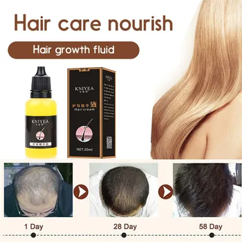 

Hair Growth Anti Hair Loss Liquid 20ml 100% Natural Extract With Natural Hair Regrowth Fast,Thicker,Hair Growth Oil