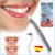 SONIC PIC purpose cleaner DENTAL ULTRASONICO Tartar smudge stick placa зубы 3000 вибраций в минуту