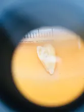 Binocular de aumento 3,5x, lupa quirúrgica con luz LED, lámpara de lupa de operación médica