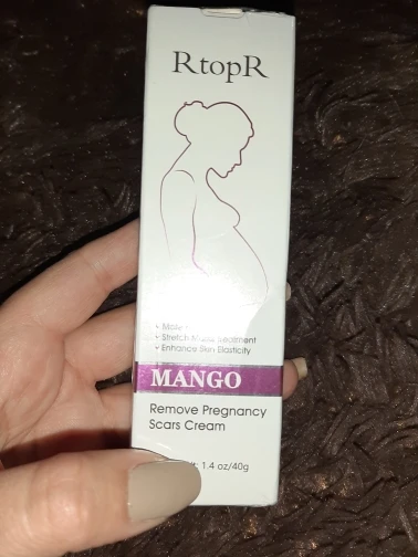Rtopr Mango Cream Reviews