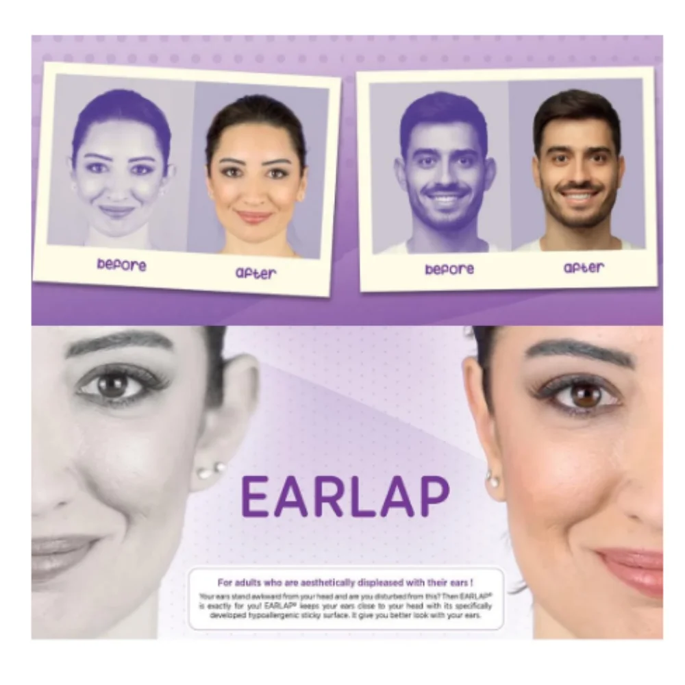 ear-corrective-beauty-tapes-earlap-cosmetics-hearing-concealer-instant-effect-adhesive-system-protruding-trend-easy-to-carry-fashion-spring-summer-autumn-winter-2022-fast-delivery-health-hygiene-on-sale-season