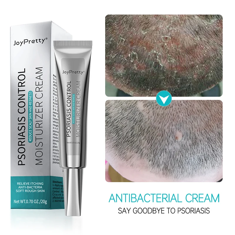 JoyPretty Herbal Psoriasis Cream Antibacterial Anti-itch Relief Eczema Skin Rash Urticaria Desquamation Treatment Body Care 20G |