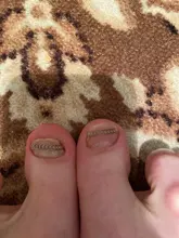 12 Uds encarnada del dedo del pie fijador de alambre para corrección de uñas pedicura paroniquia recuperar Corrector de uñas de pie de cuidado de los pies herramienta