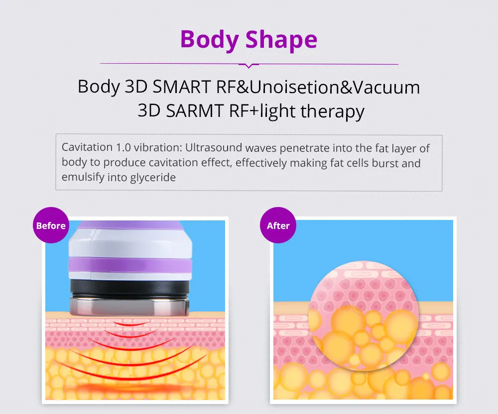 US $580.00 6In 1 20 Cavitation 40K Fat Removal Radio Frquency Vacuum RF Slimming Weight Loss Machine LED Photon Face Skin Care