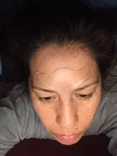 Almohadillas de silicona VIP Link, parches antigripal, pegatina de extracción, cara, cuello, etiqueta adhesiva para ojos, 16 Uds.