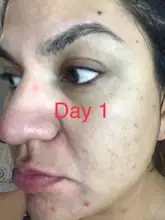 Suero facial con ampolla de vitamina C, blanqueador, antiarrugas, hidratante, reduce los poros, repara el cuidado de la piel facial