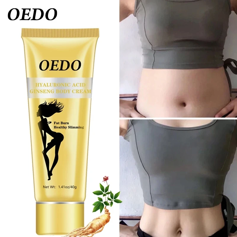 OEDO slimming cream hyaluronic acid ginseng weight loss cream, reduce fat loss, burn fat loss cream, healthy burn cream