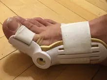 Juanete férula del dedo gordo del pie plancha Corrector de pie alivio del dolor del Hallux Valgus corrección ortopédicos suministros pedicura para el cuidado de los pies