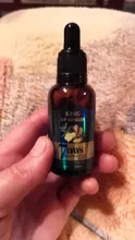 Aceite de esencia de crecimiento de pelo rápido, suero para el crecimiento del cabello de jengibre, tratamiento nutritivo para suavizar la pérdida de cabello, reparación de cabello dañado, 10/30ML, 7 días
