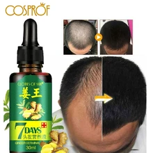 Масло для роста волос, эссенция, жидкость для выпадения волос, густые утолщенные волосы, поддерживает здоровый рост волос, для женщин и мужчин, восстановление поврежденных волос