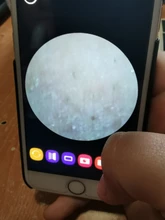 Clean-Skin-Tool Pore-Acne-Pimple-Removal Blackhead-Remover Deep-Nose-Cleaner Vacuum-Suction