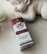 Esencia rápida y potente para el crecimiento del cabello, productos para la pérdida del cabello, tratamiento líquido de aceite esencial, productos para el cuidado del cabello, 20ml