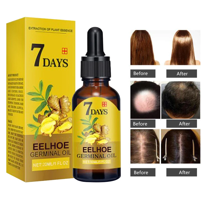 Ginger Hair Growth Serum Fast Growing Hair Essential Oil Prevent Hair Loss Thinning Dry Frizzy Damaged Repair Hair Care Products