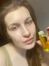 Esencia rápida y potente para el crecimiento del cabello, productos para la pérdida del cabello, tratamiento líquido de aceite esencial, productos para el cuidado del cabello, 20ml