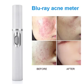 

Blue Light Therapy Acne Laser Pen Soft Scar Wrinkle Removal Treatment Device Face Skin Care Beauty Equipment KD-7910