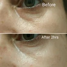 Pegatina de extracción de arrugas reutilizable de silicona, parche antiedad para cara, cuello, etiqueta adhesiva para ojos, mascarilla de estiramiento facial, herramientas de cuidado de la piel
